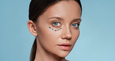 dark circle treatment laser